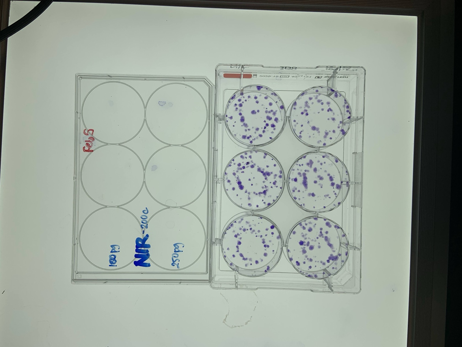 A plate assay with stained cell colonies